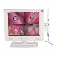 High Resolution WIFI Intra Oral Camera 15 inch LCD 1/4 SONY CCD 
